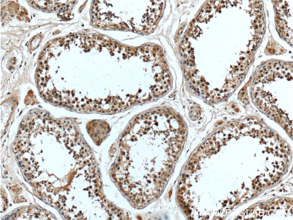 Immunohistochemistry (IHC) staining of human testis tissue using BRCA1 Monoclonal antibody (66267-1-Ig)