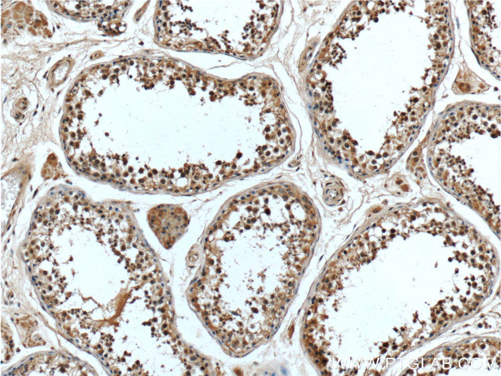 IHC staining of human testis using 66267-1-Ig