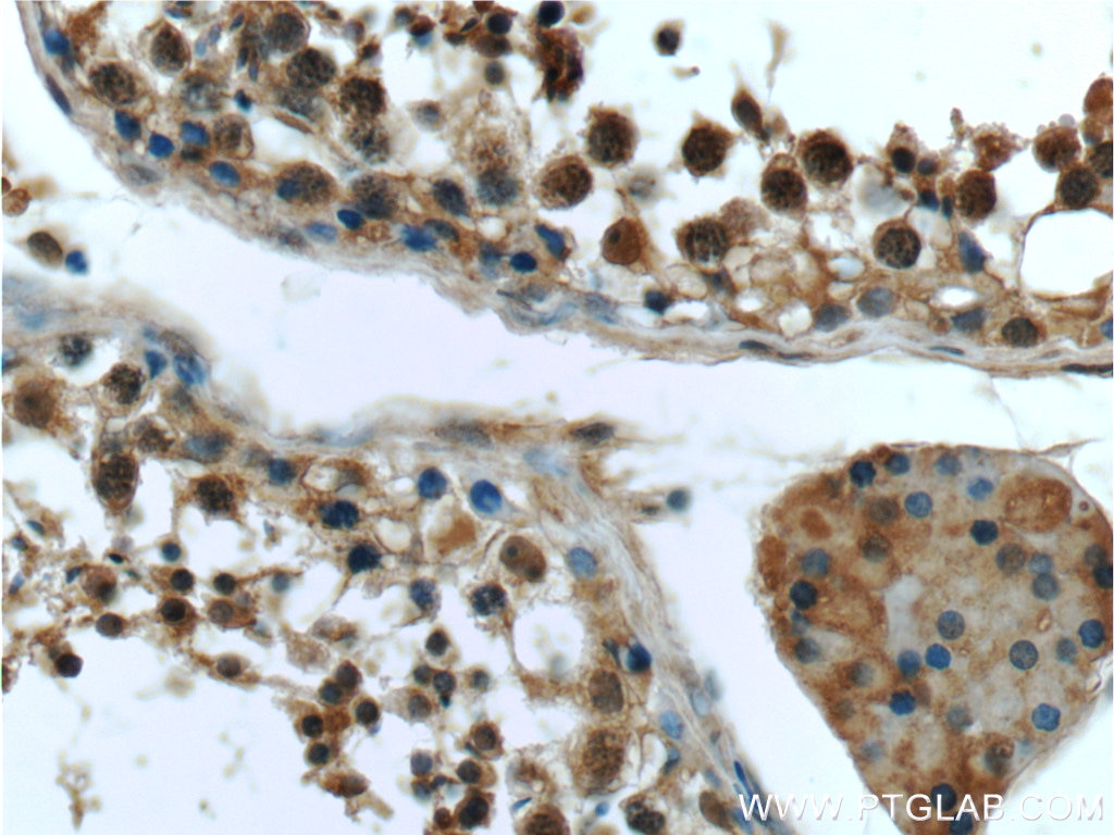 Immunohistochemistry (IHC) staining of human testis tissue using BRCA1 Monoclonal antibody (66267-1-Ig)