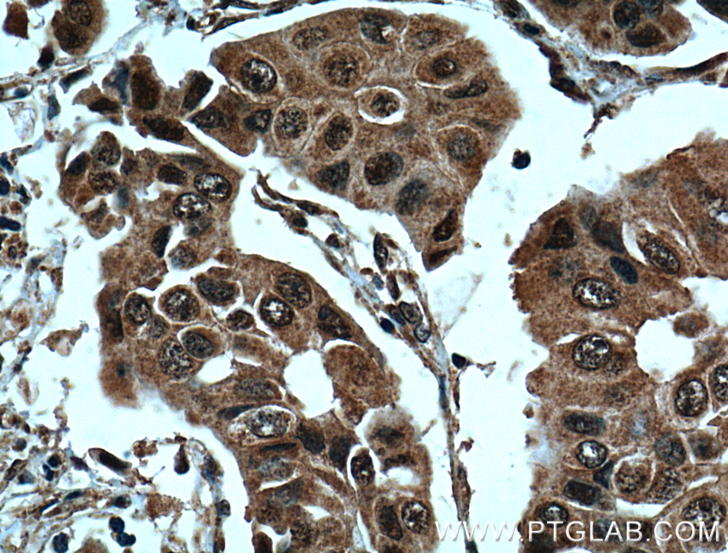 BRCA1 Monoclonal antibody