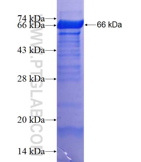 BRCA1 fusion protein Ag17946 SDS-PAGE