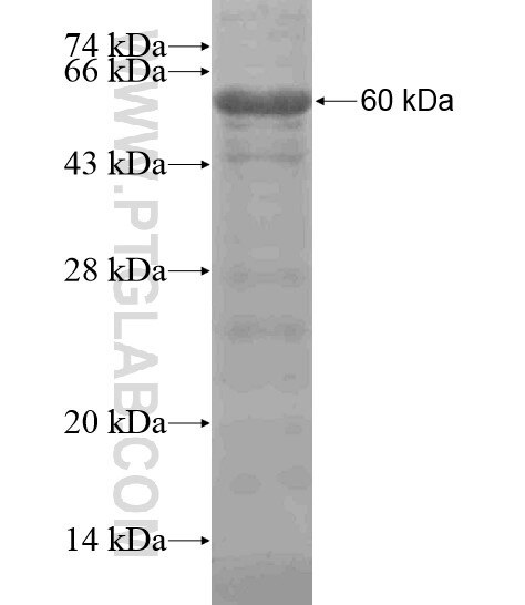 BRCA1 fusion protein Ag19178 SDS-PAGE