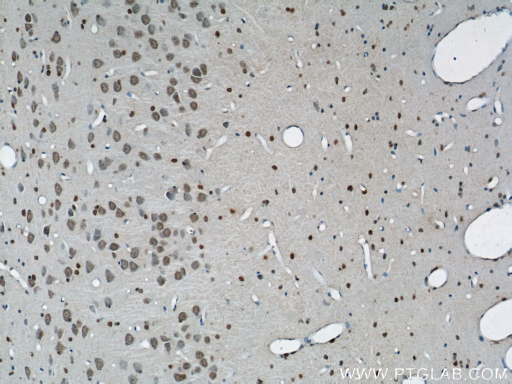 BRCA2 Polyclonal antibody