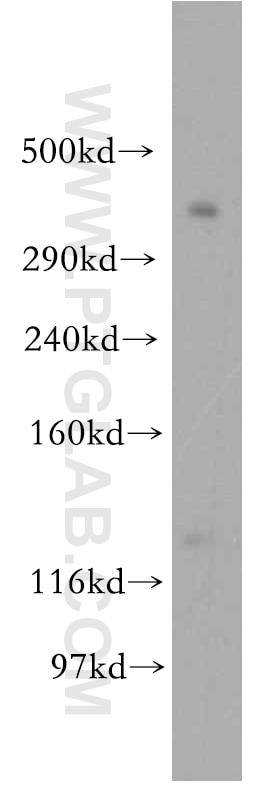 Western Blot (WB) analysis of HeLa cells using BRCA2 Polyclonal antibody (19791-1-AP)