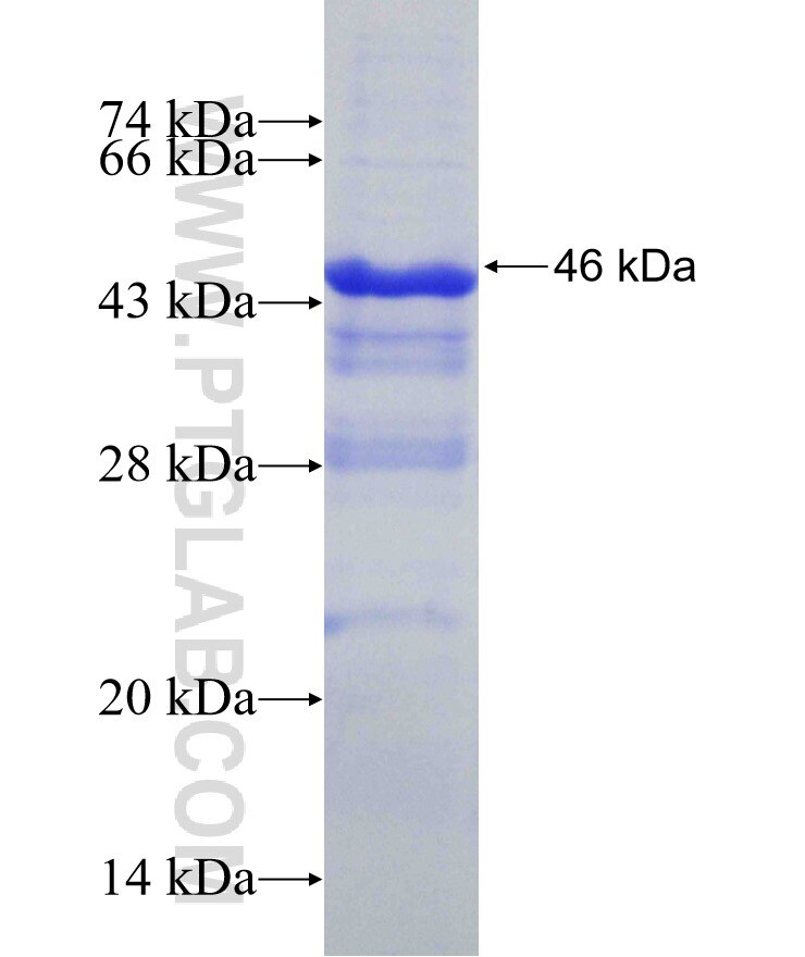 BRCA2 fusion protein Ag31064 SDS-PAGE