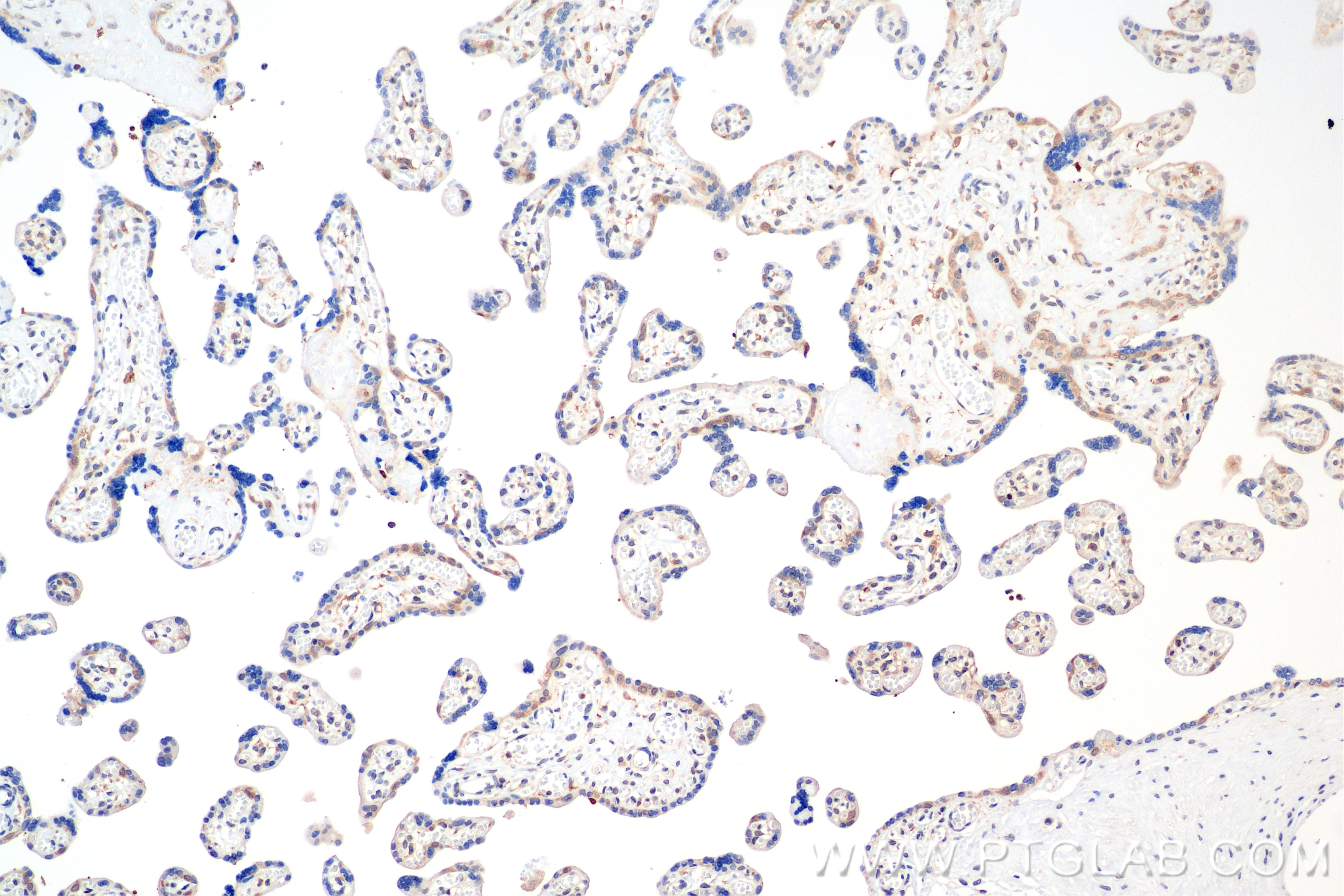 Immunohistochemistry (IHC) staining of Human placenta tissue using BRCC3 Recombinant antibody (85430-4-RR)