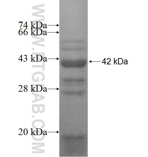 BRCC3 fusion protein Ag7578 SDS-PAGE