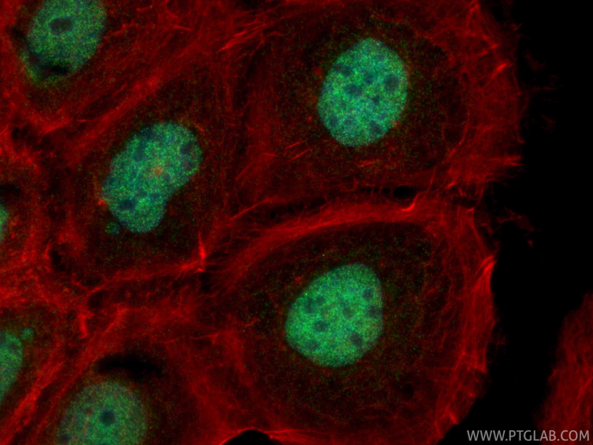 IF Staining of A431 using 32452-1-AP Immunofluorescence (IF) / fluorescent staining of A431 cells using BRD1/BRL Polyclonal antibody (32452-1-AP)