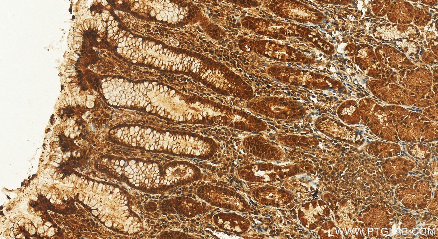 Immunohistochemistry (IHC) staining of human stomach tissue using BRD2 Polyclonal antibody (22236-1-AP)
