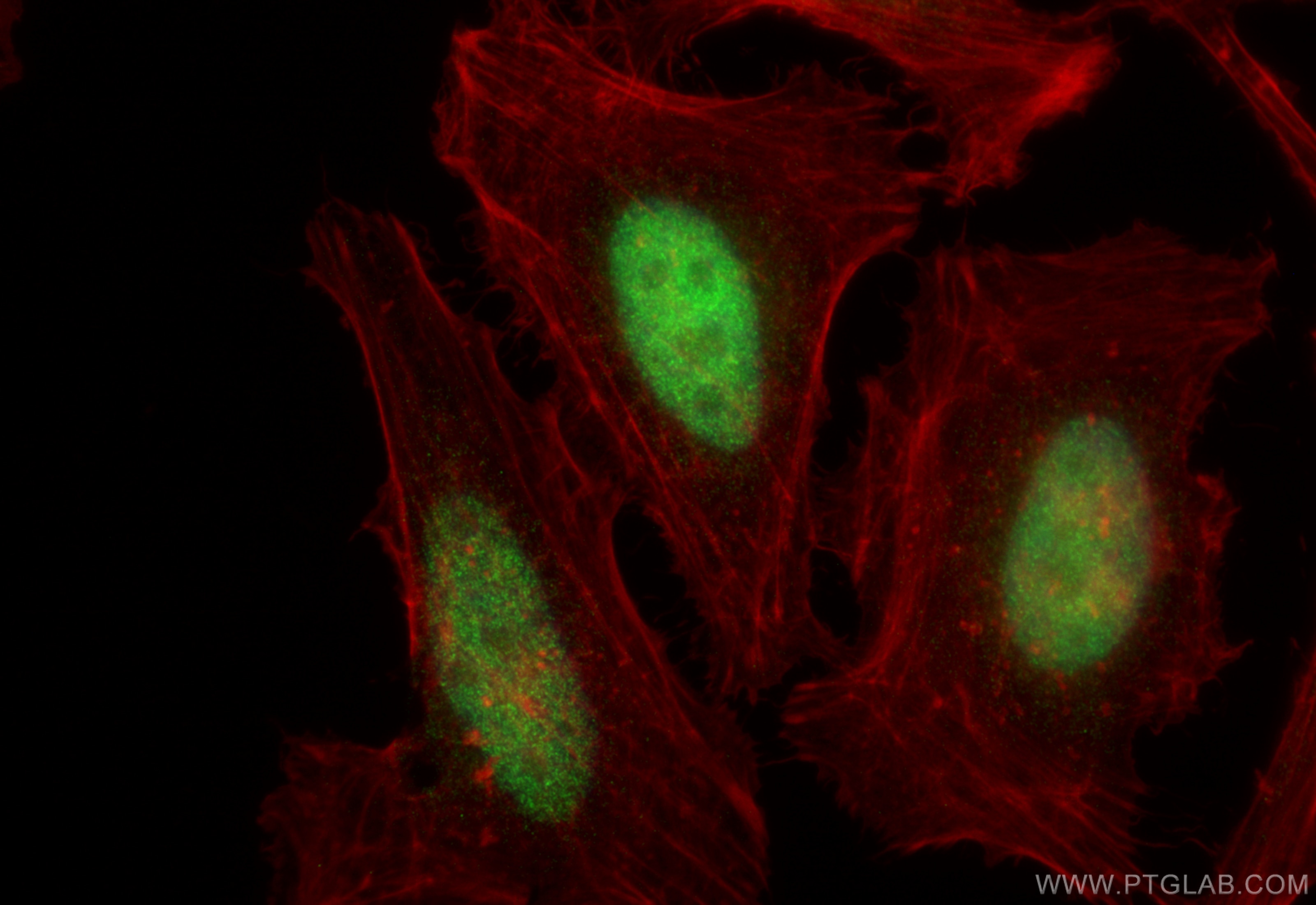 Immunofluorescence (IF) / fluorescent staining of HeLa cells using BRD2 Polyclonal antibody (22236-1-AP)