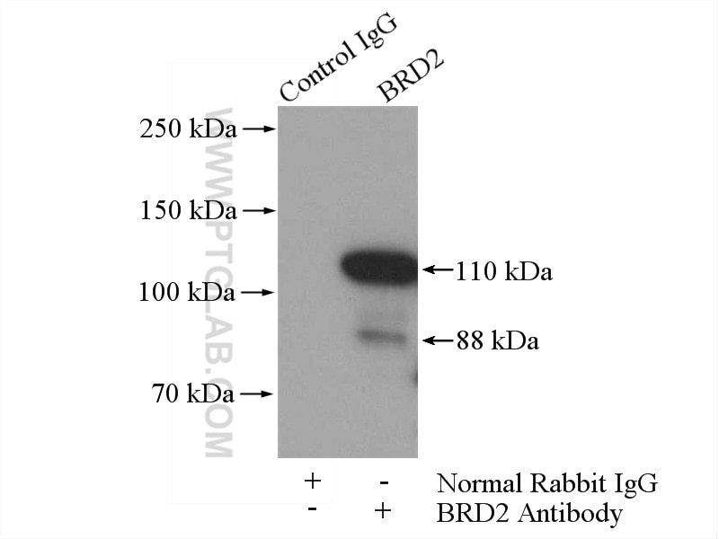 IP experiment of HeLa using 22236-1-AP