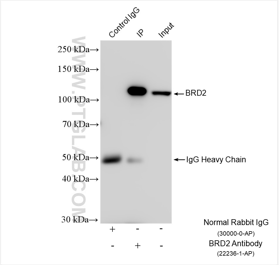Immunoprecipitation (IP) experiment of HeLa cells using BRD2 Polyclonal antibody (22236-1-AP)
