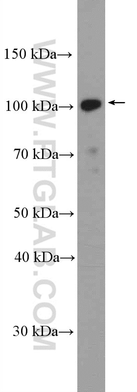 Western Blot (WB) analysis of HeLa cells using BRD2 Polyclonal antibody (22236-1-AP)