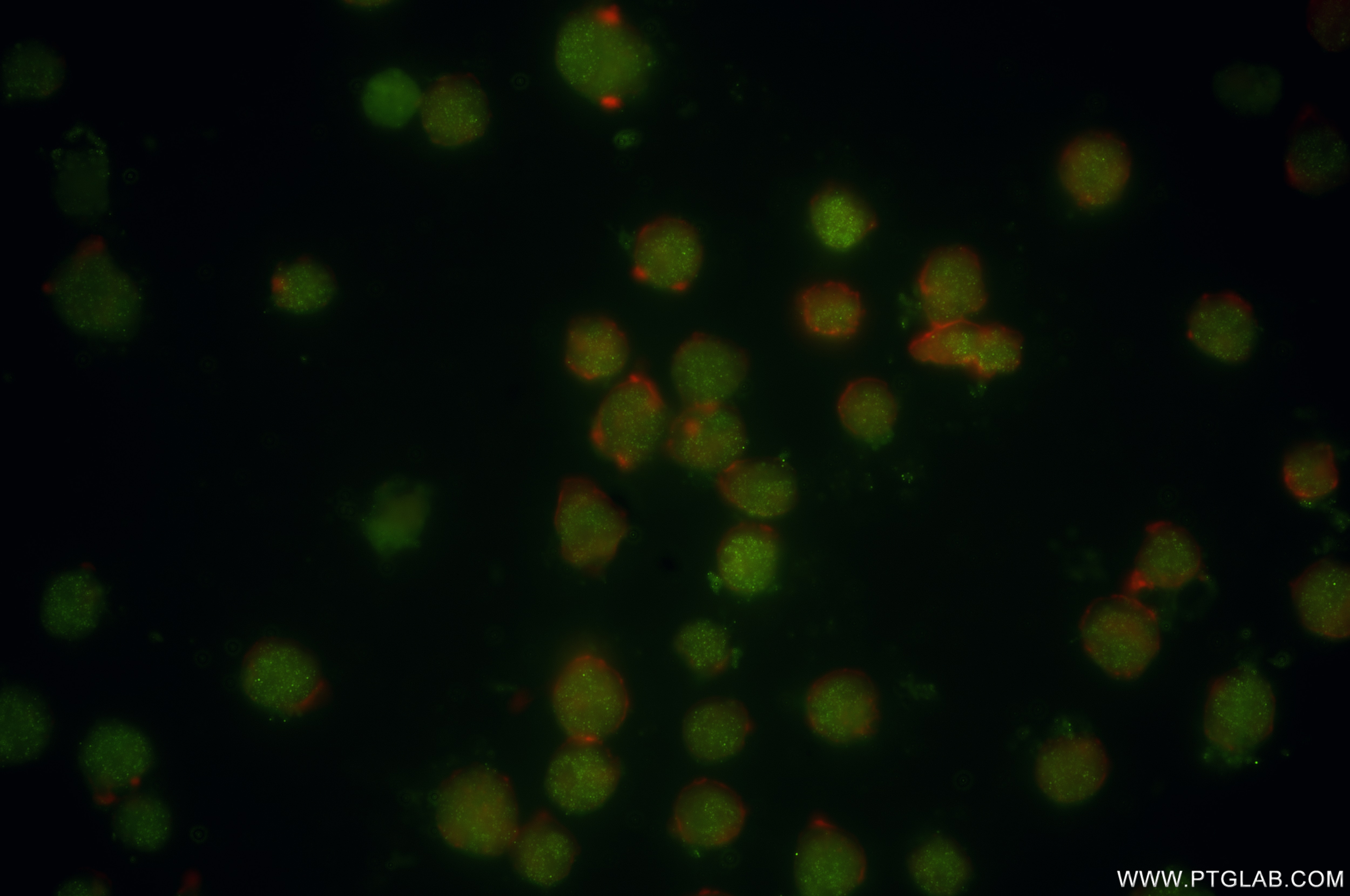 Immunofluorescence (IF) / fluorescent staining of Jurkat cells using BRD2 Recombinant antibody (85990-2-RR)