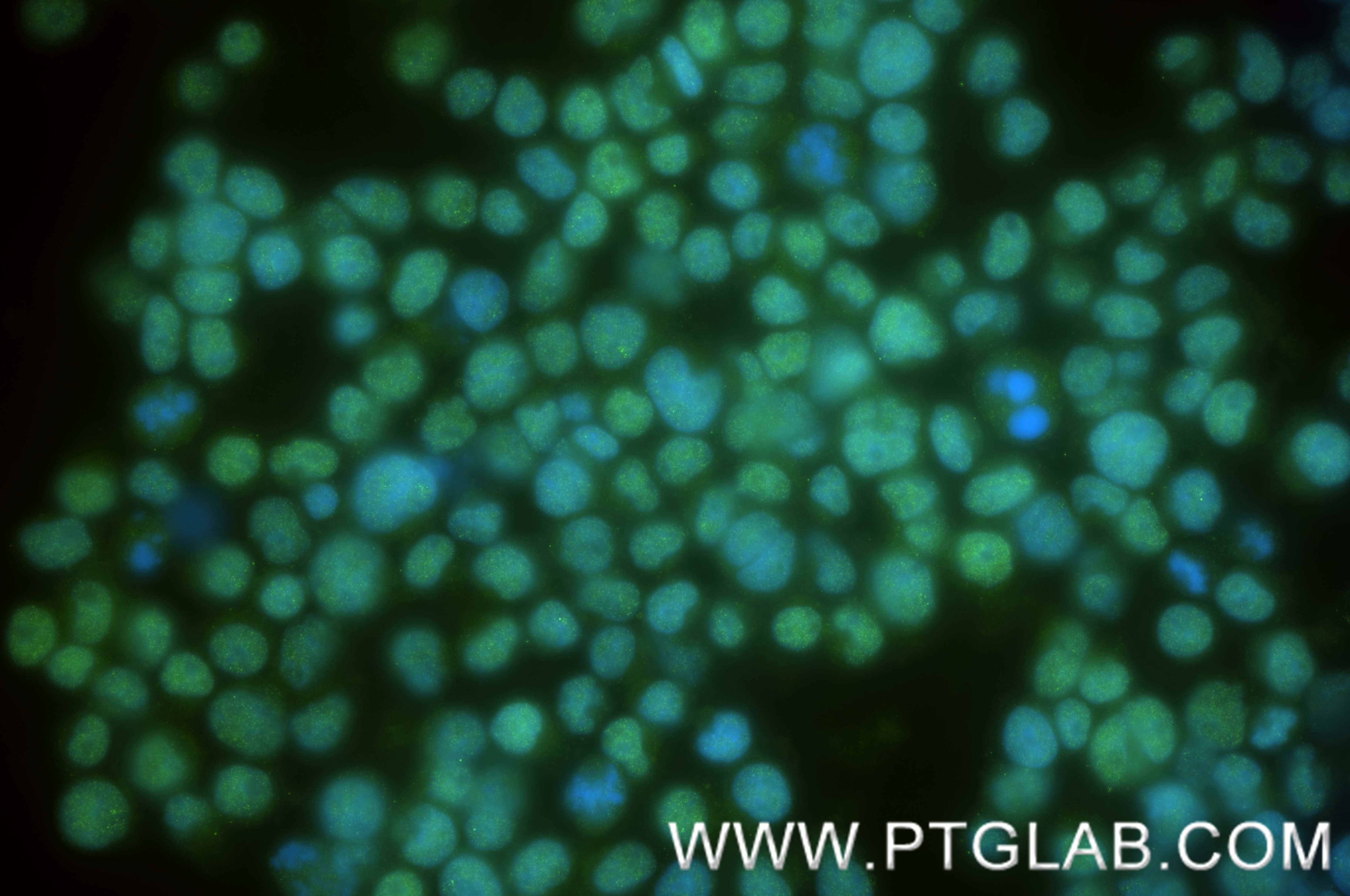 Immunofluorescence (IF) / fluorescent staining of Jurkat cells using BRD2 Recombinant antibody (85990-2-RR)