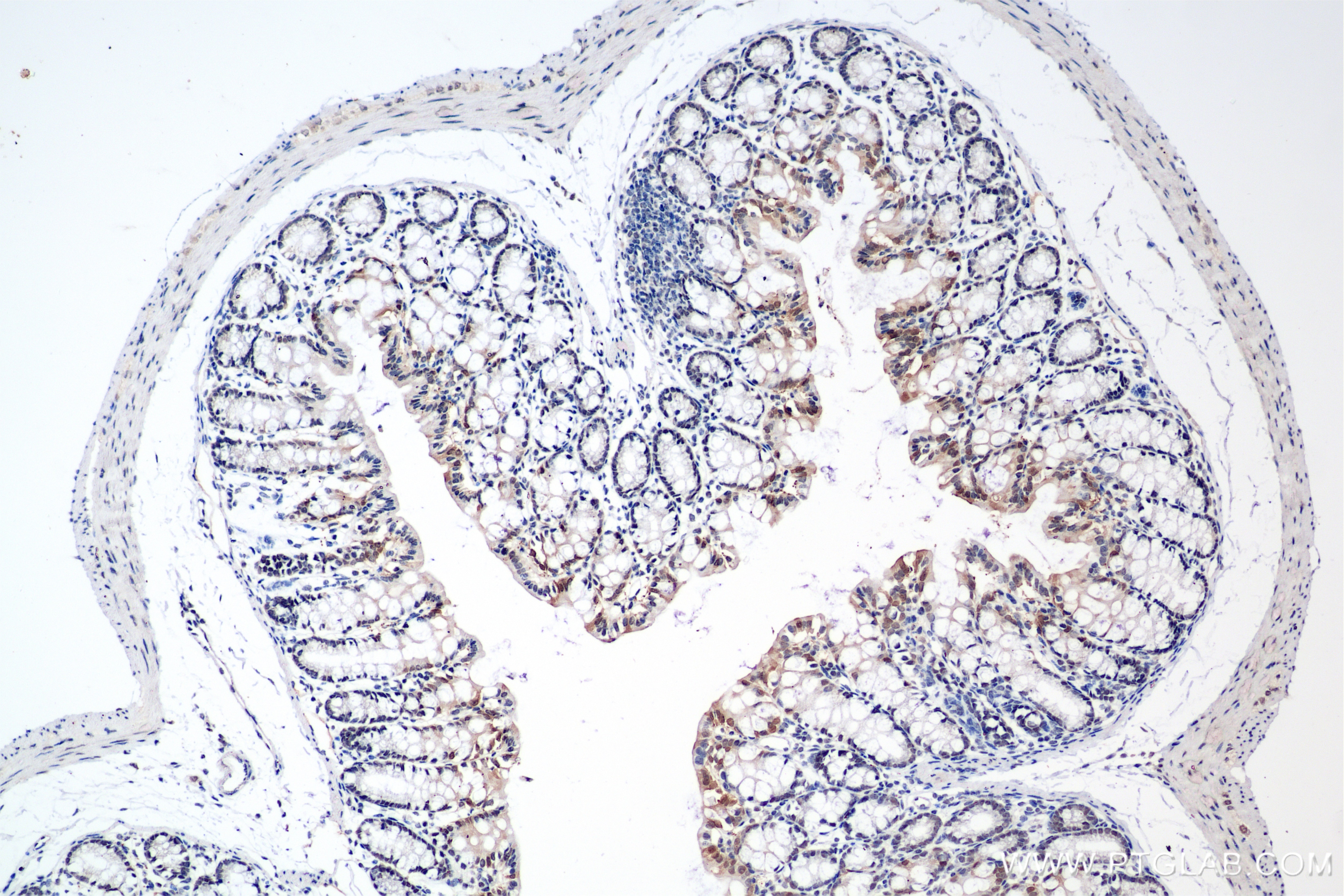 Immunohistochemistry (IHC) staining of mouse colon tissue using BRD2 Recombinant antibody (85990-2-RR)