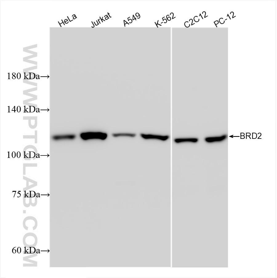 Western Blot (WB) analysis of various lysates using BRD2 Recombinant antibody (85990-2-RR)