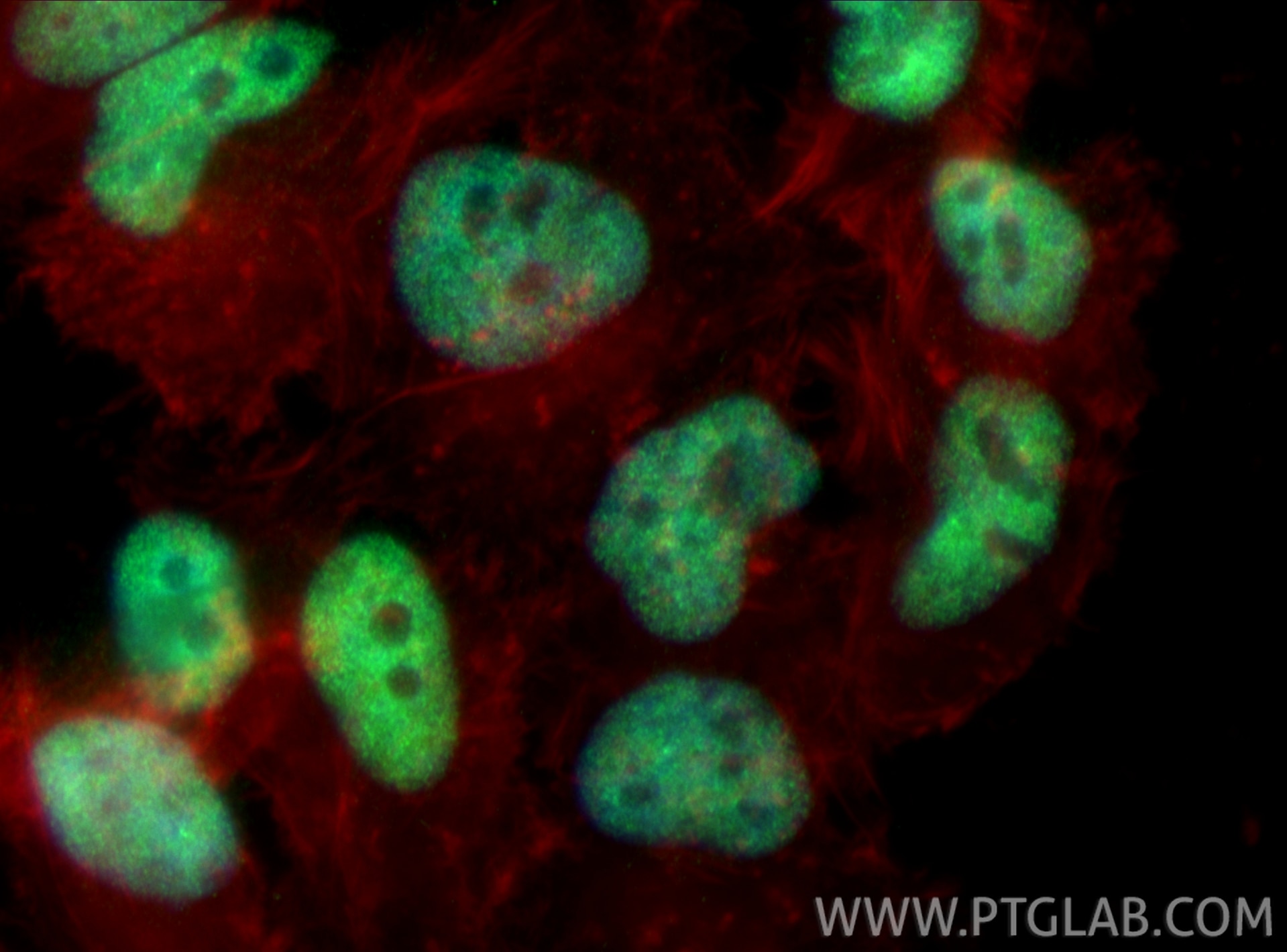 IF Staining of HeLa using RMX00117 Immunofluorescence (IF) / fluorescent staining of HeLa cells using Multi-rAb® BRD2 Multi-Recombinant antibody (RMX00117)