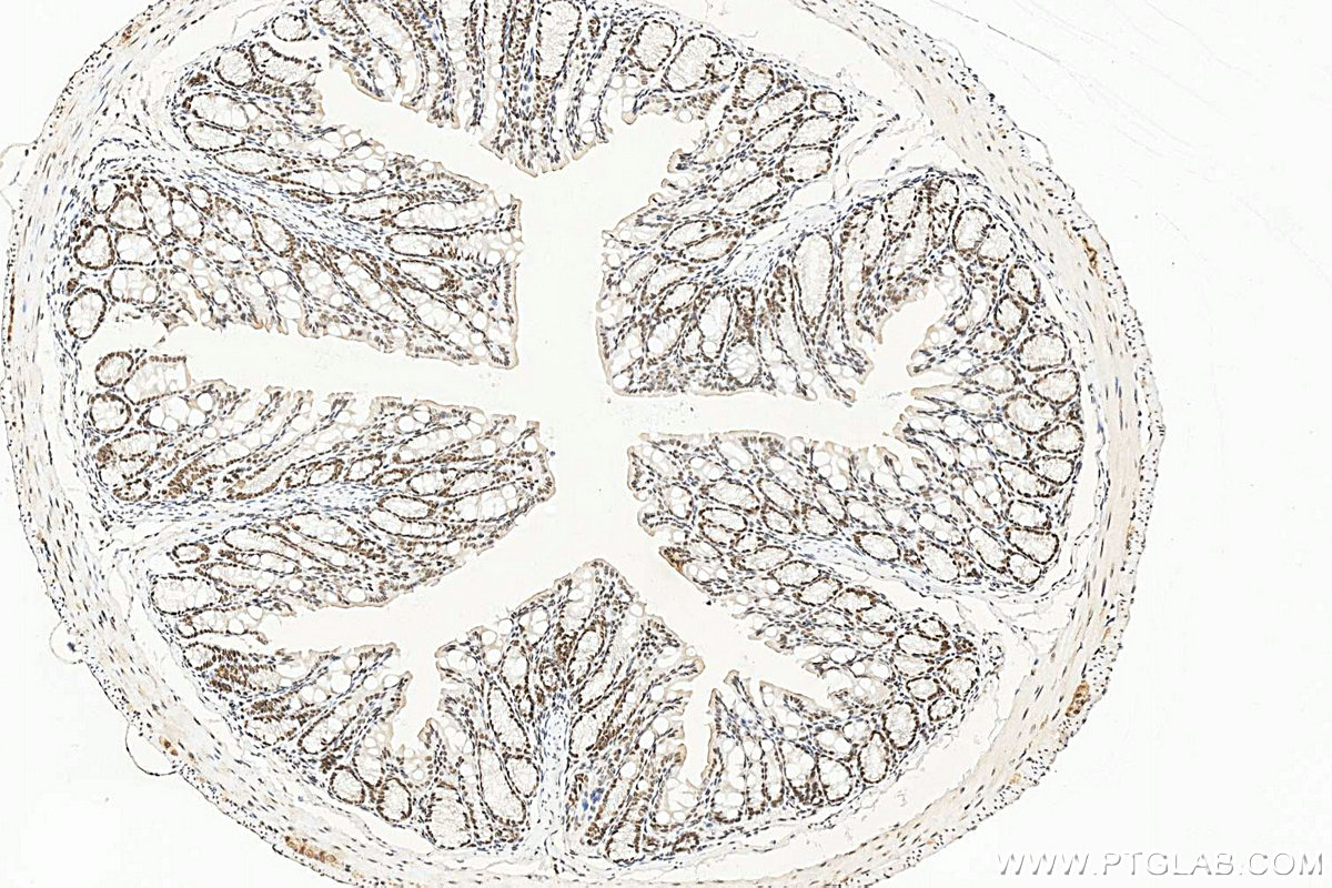 IHC staining of mouse colon using RMX00117 Immunohistochemistry (IHC) staining of mouse colon tissue using Multi-rAb® BRD2 Multi-Recombinant antibody (RMX00117)
