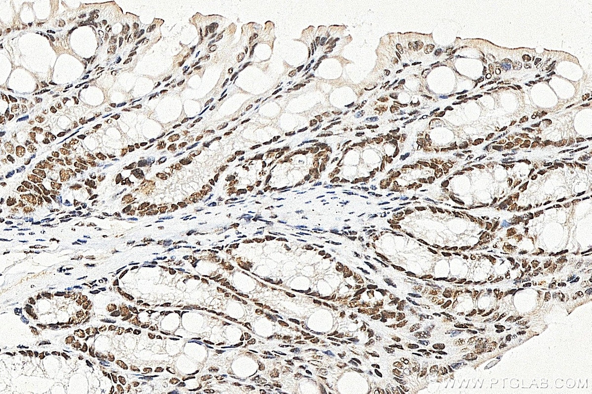 IHC staining of mouse colon using RMX00117 Immunohistochemistry (IHC) staining of mouse colon tissue using Multi-rAb® BRD2 Multi-Recombinant antibody (RMX00117)
