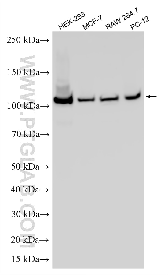 WB analysis using RMX00117 Western Blot (WB) analysis of various lysates using Multi-rAb® BRD2 Multi-Recombinant antibody (RMX00117)