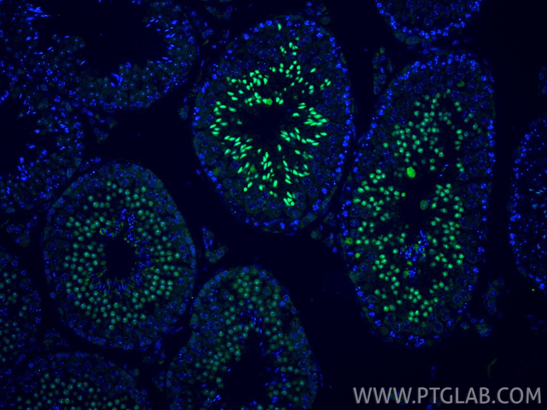Immunofluorescence (IF) / fluorescent staining of mouse testis tissue using BRD3 Polyclonal antibody (11859-1-AP)