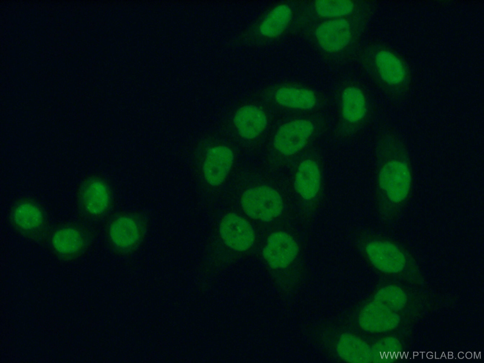 Immunofluorescence (IF) / fluorescent staining of HeLa cells using BRD3 Polyclonal antibody (11859-1-AP)
