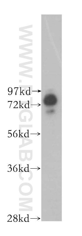 Western Blot (WB) analysis of COLO 320 cells using BRD3 Polyclonal antibody (11859-1-AP)