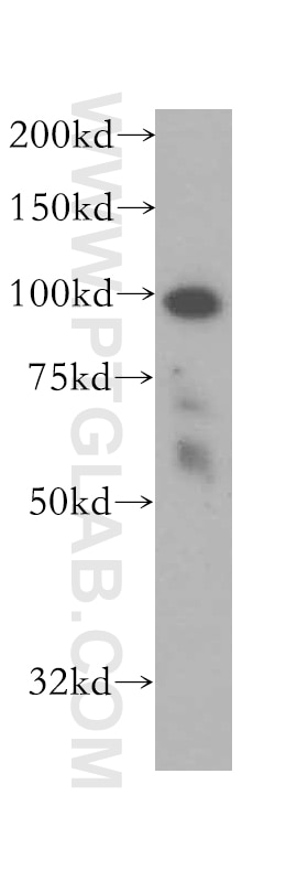 Western Blot (WB) analysis of HeLa cells using BRD3 Polyclonal antibody (11859-1-AP)