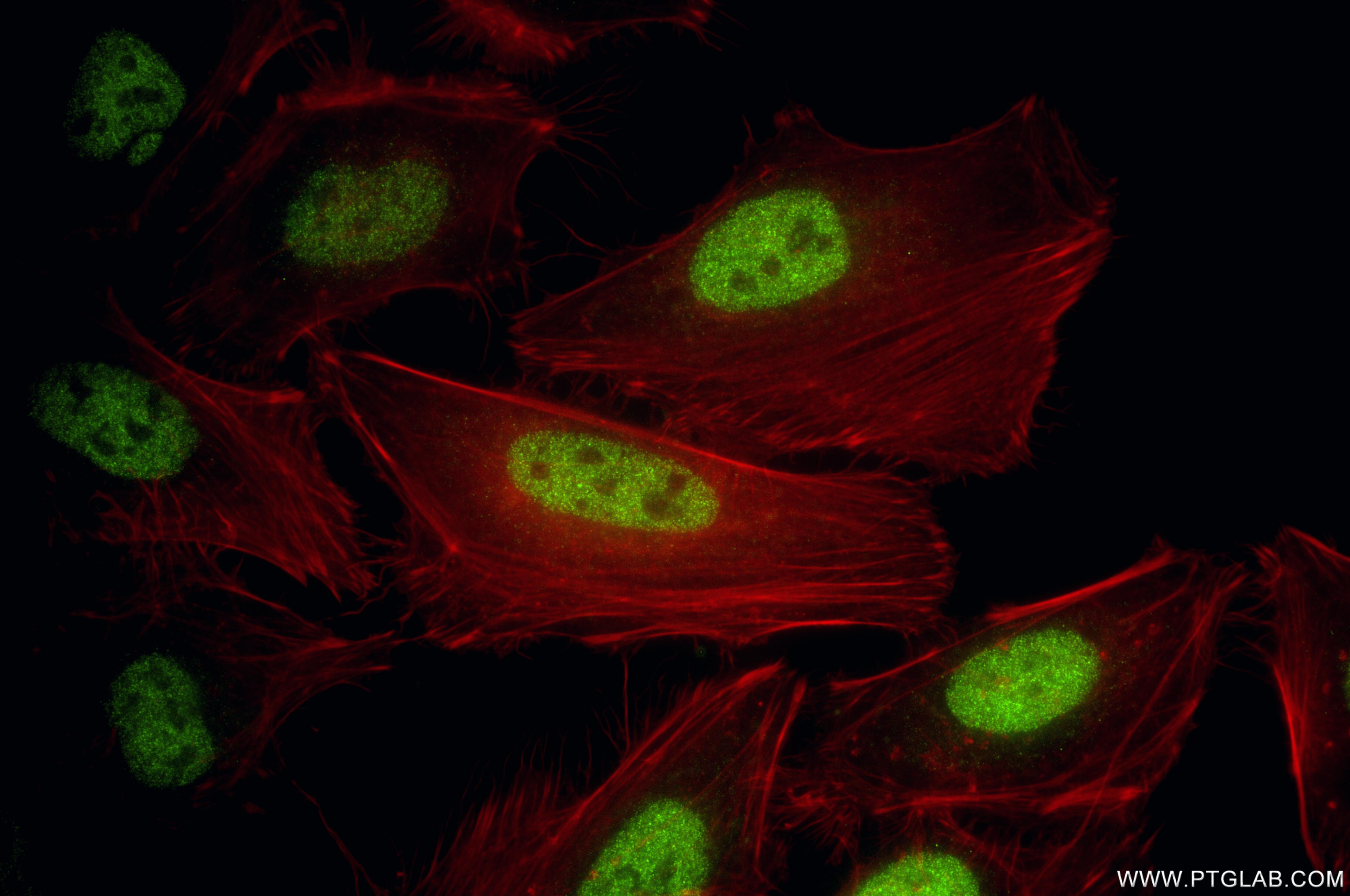 Immunofluorescence (IF) / fluorescent staining of HeLa cells using BRD3 Recombinant monoclonal antibody (87030-3-RR)
