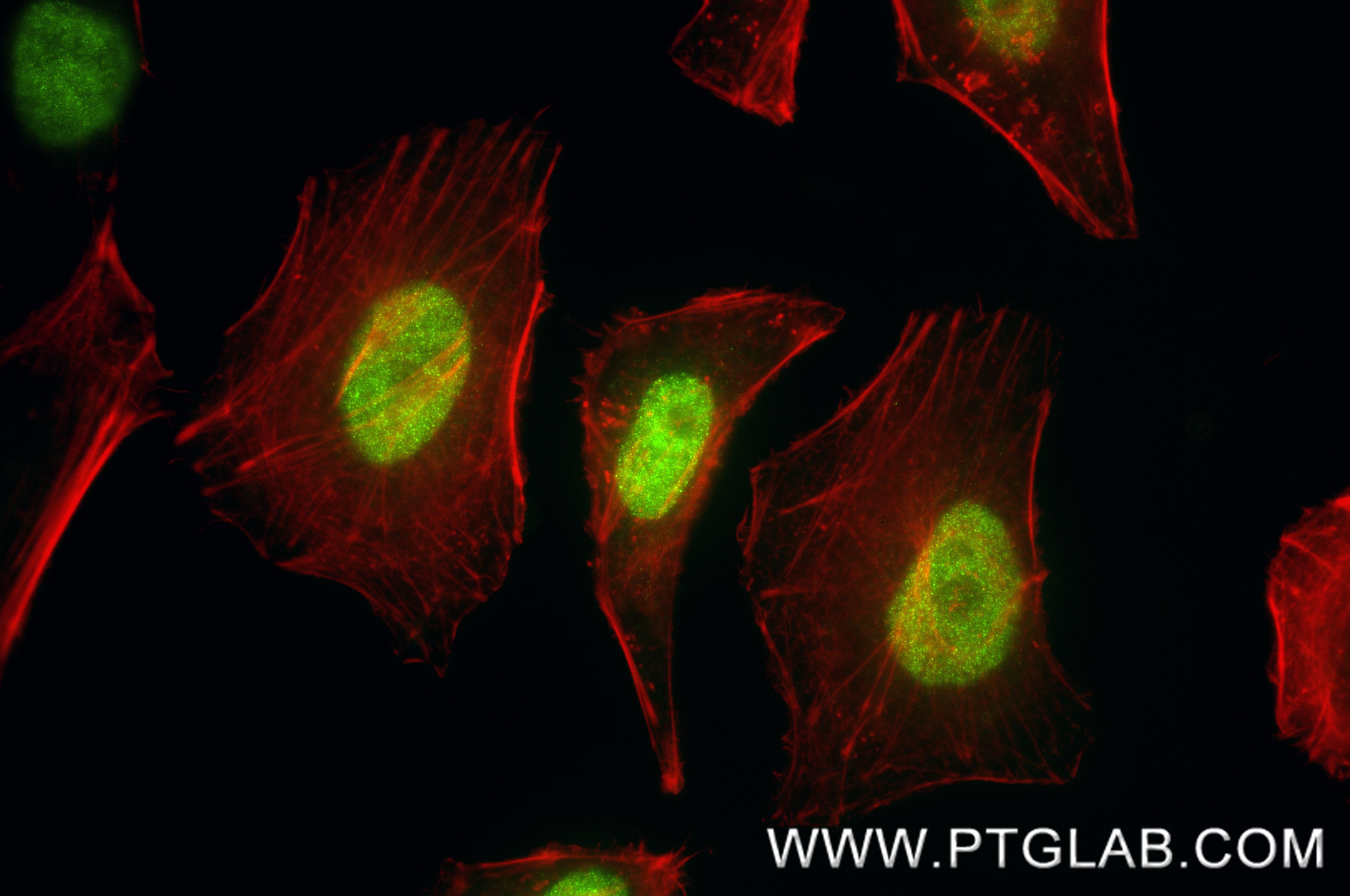 Immunofluorescence (IF) / fluorescent staining of HeLa cells using BRD3 Recombinant monoclonal antibody (87030-5-RR)