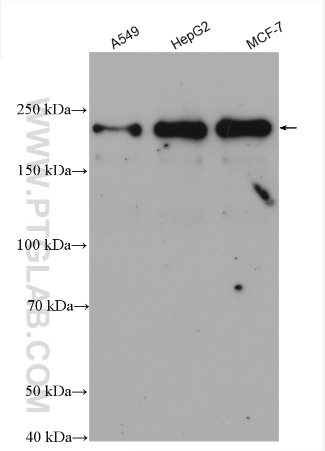 Western Blot (WB) analysis of various lysates using BRD4 Polyclonal antibody (28486-1-AP)