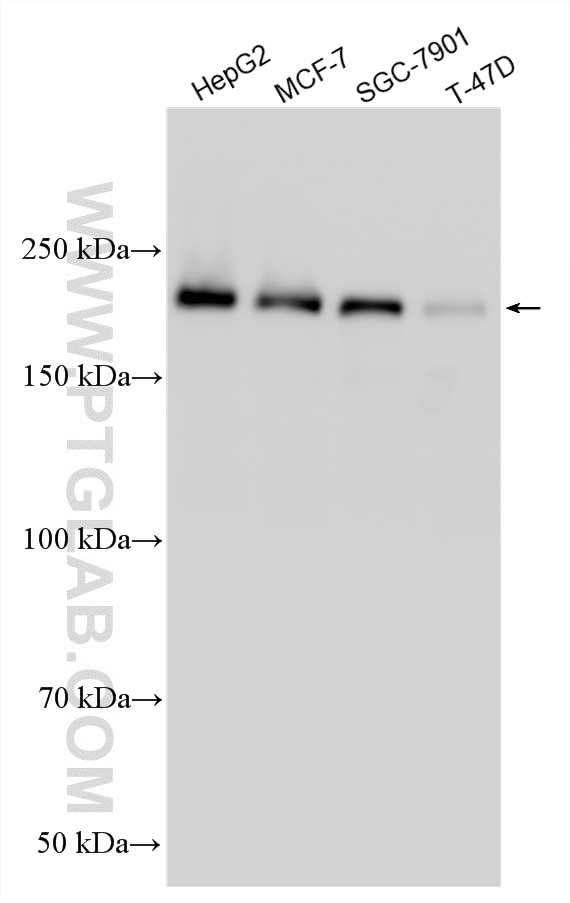 Western Blot (WB) analysis of various lysates using BRD4 Polyclonal antibody (28486-1-AP)