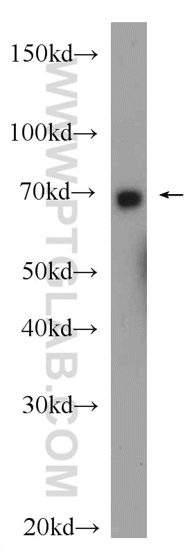 Western Blot (WB) analysis of rat brain tissue using BRD7 Polyclonal antibody (51009-2-AP)