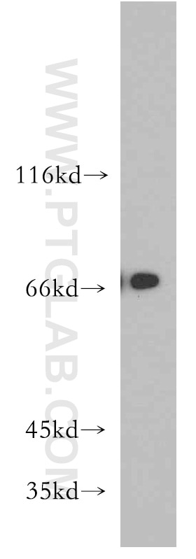 Western Blot (WB) analysis of L02 cells using BRD7 Polyclonal antibody (51009-2-AP)