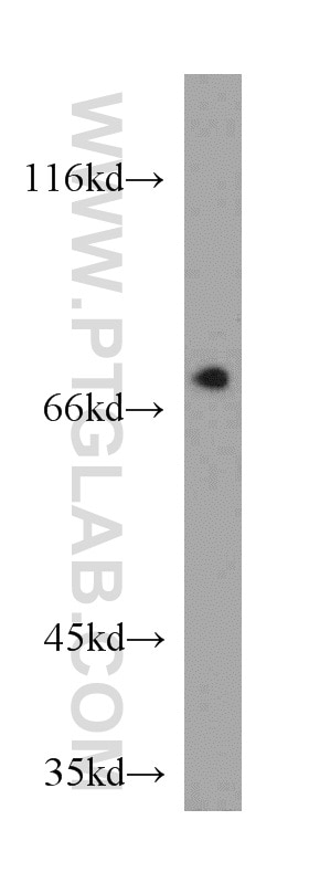 Western Blot (WB) analysis of mouse cerebellum tissue using BRD7 Polyclonal antibody (51009-2-AP)