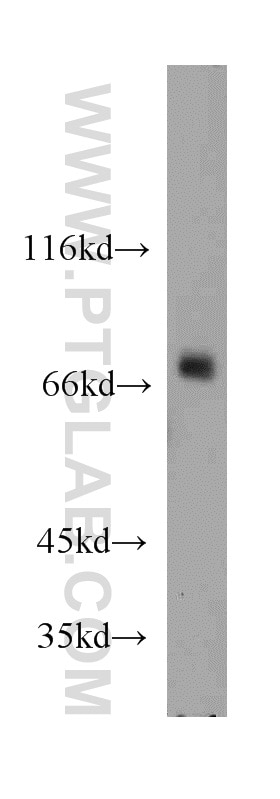 Western Blot (WB) analysis of mouse lung tissue using BRD7 Polyclonal antibody (51009-2-AP)