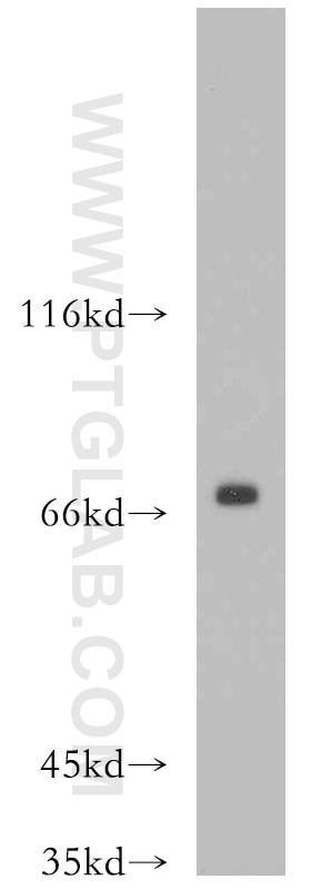 Western Blot (WB) analysis of SH-SY5Y cells using BRD7 Polyclonal antibody (51009-2-AP)