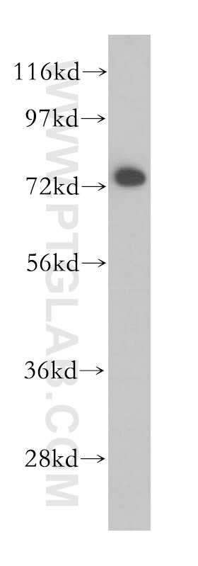 Western Blot (WB) analysis of HeLa cells using BRD7 Polyclonal antibody (51009-2-AP)