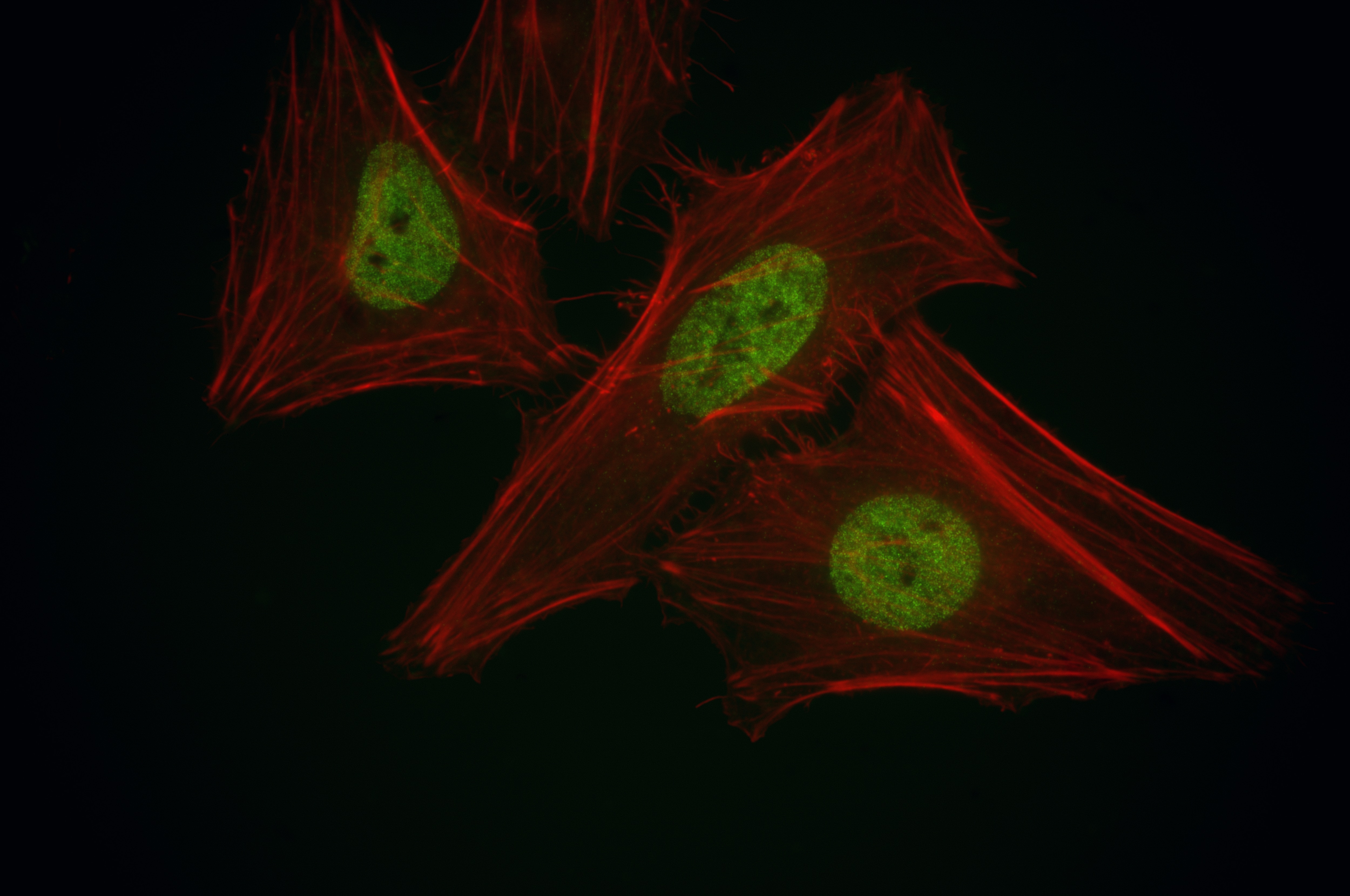 Immunofluorescence (IF) / fluorescent staining of HeLa cells using BRD7 Recombinant antibody (86176-1-RR)