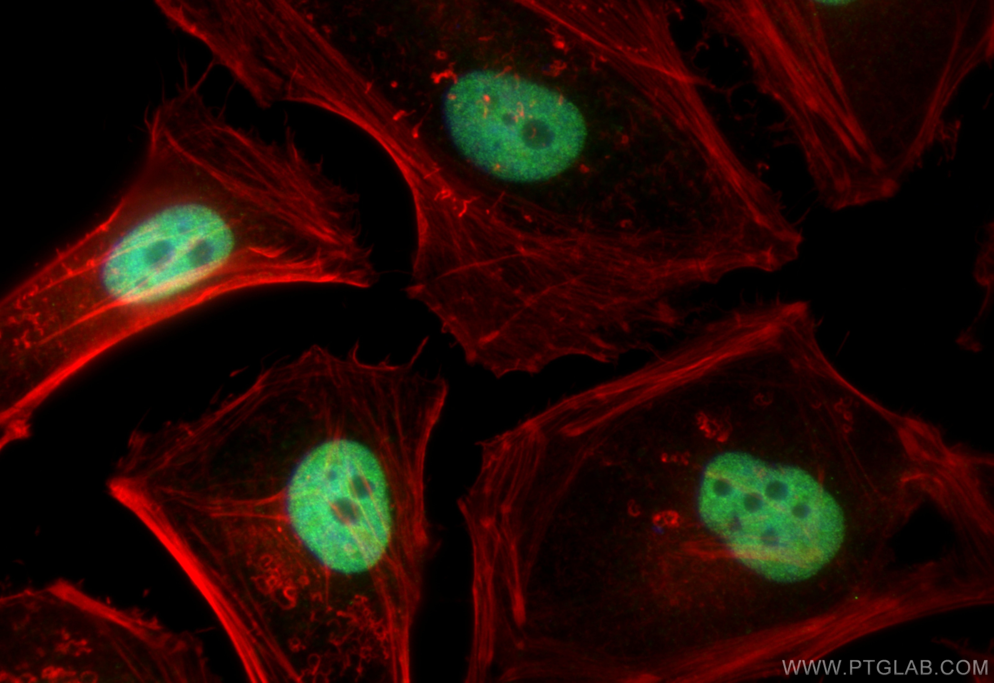 Immunofluorescence (IF) / fluorescent staining of HeLa cells using BRD8 Polyclonal antibody (10476-1-AP)