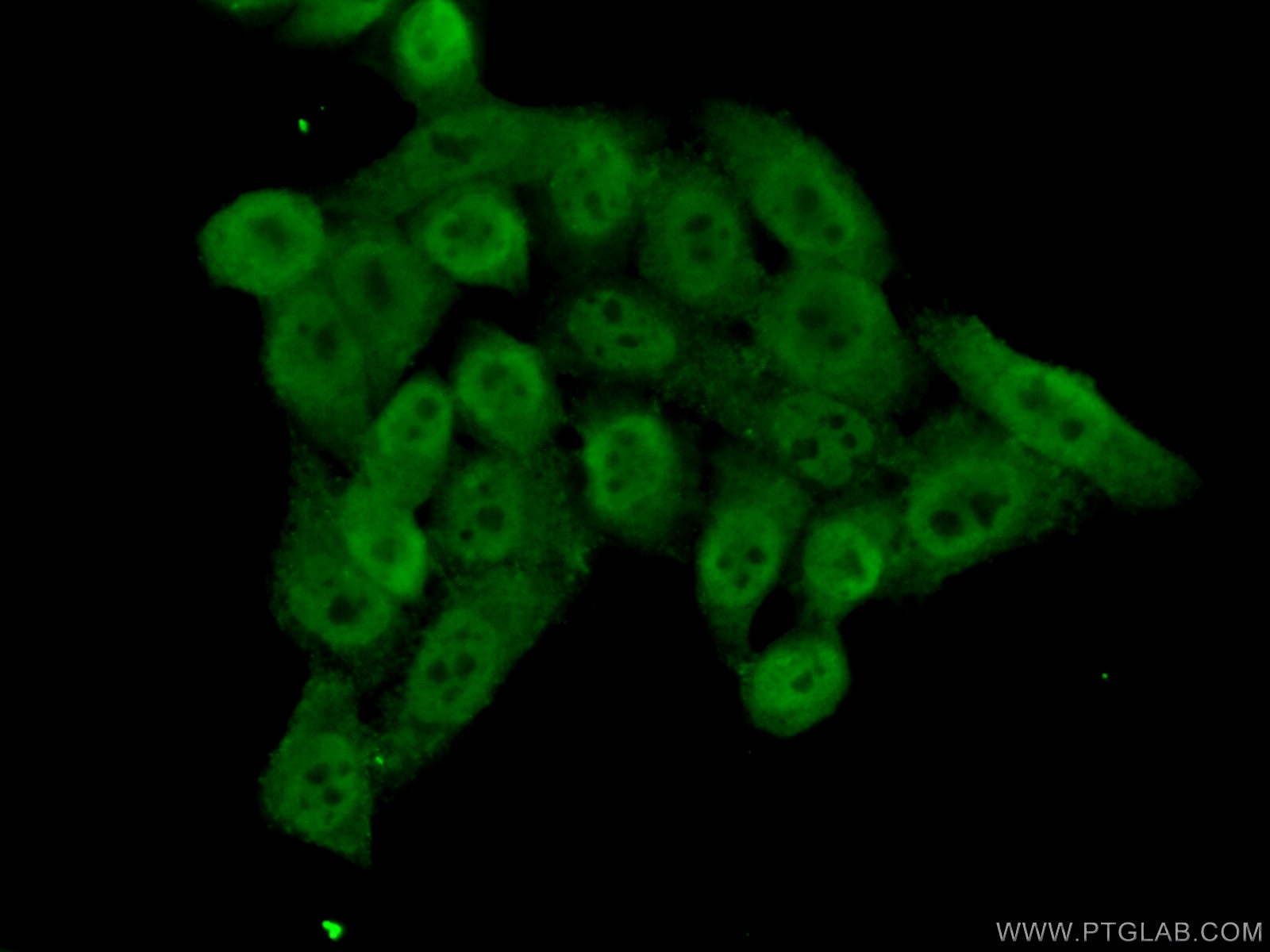 Immunofluorescence (IF) / fluorescent staining of HeLa cells using BRD8 Polyclonal antibody (10476-1-AP)