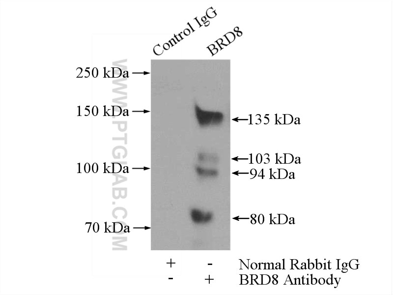 Immunoprecipitation (IP) experiment of HeLa cells using BRD8 Polyclonal antibody (10476-1-AP)