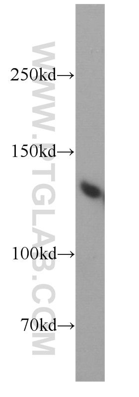 Western Blot (WB) analysis of HeLa cells using BRD8 Polyclonal antibody (10476-1-AP)