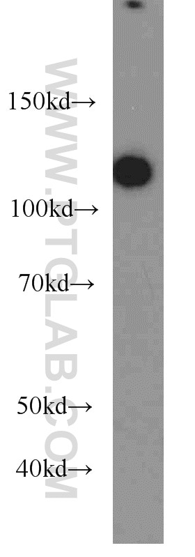 Western Blot (WB) analysis of human brain tissue using BRD8 Polyclonal antibody (10476-1-AP)