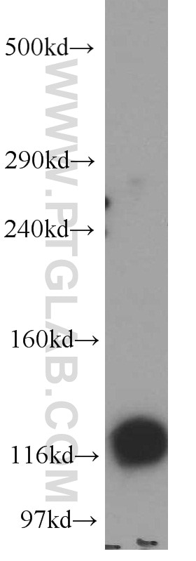 Western Blot (WB) analysis of human brain tissue using BRD8 Polyclonal antibody (10476-1-AP)