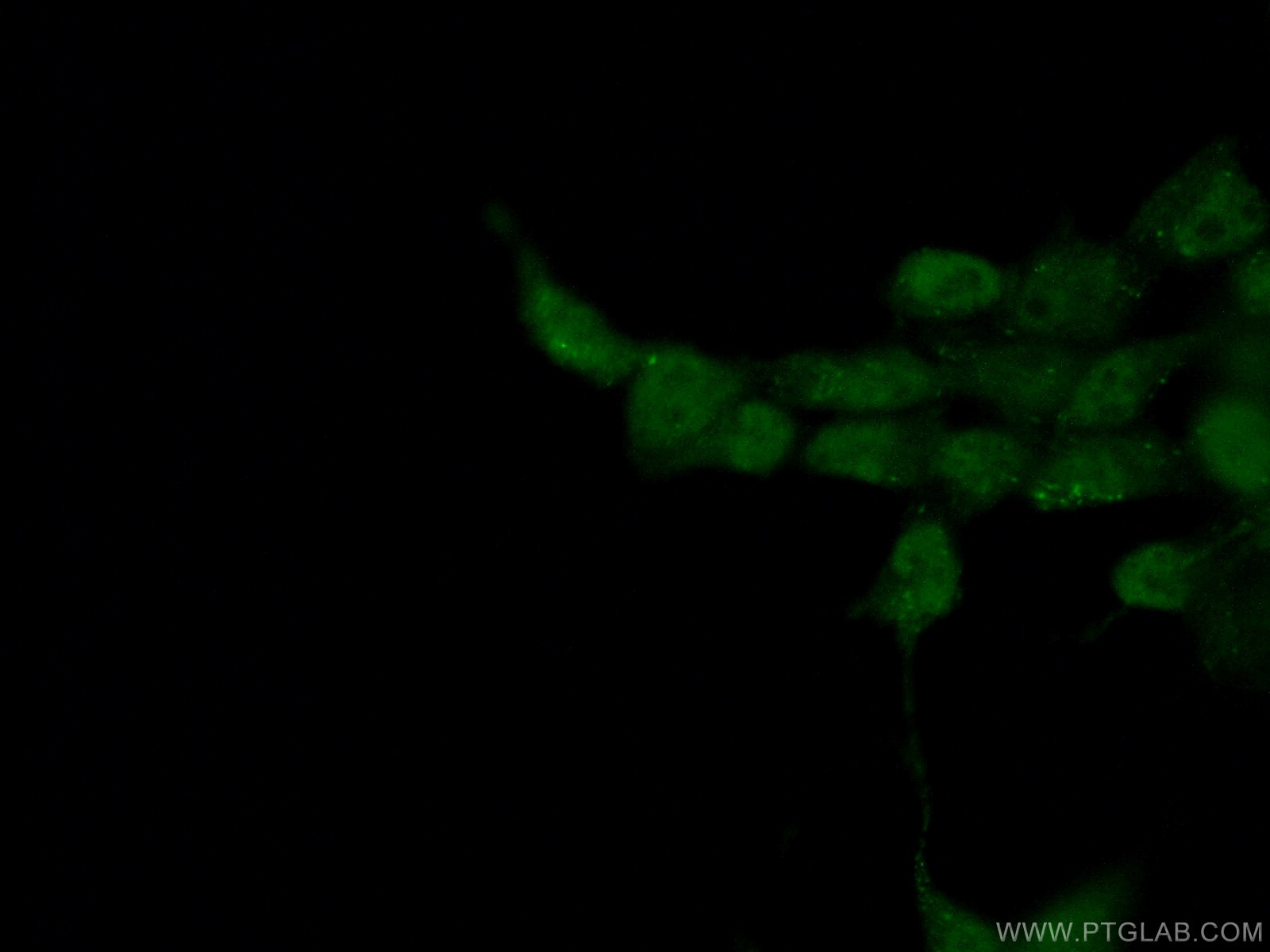 Immunofluorescence (IF) / fluorescent staining of HEK-293 cells using BRD8 Monoclonal antibody (60121-1-Ig)