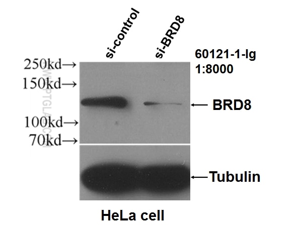 Western Blot (WB) analysis of HeLa cells using BRD8 Monoclonal antibody (60121-1-Ig)