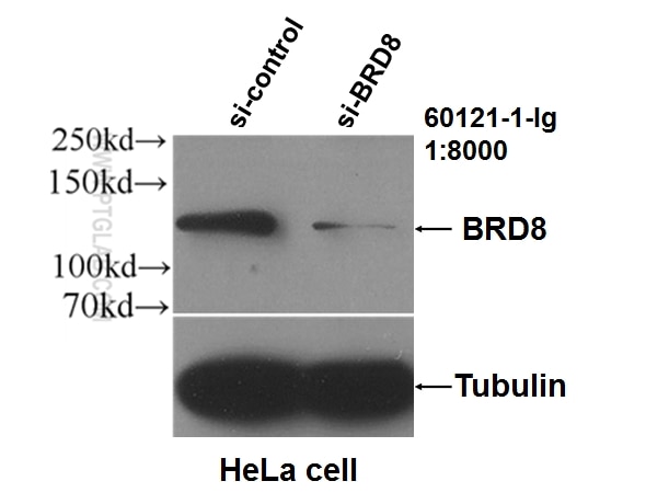 WB analysis of HeLa using 60121-1-Ig