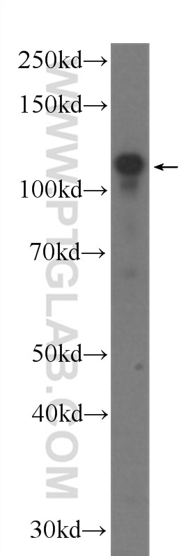 Western Blot (WB) analysis of fetal human brain tissue using BRD8 Monoclonal antibody (60121-1-Ig)